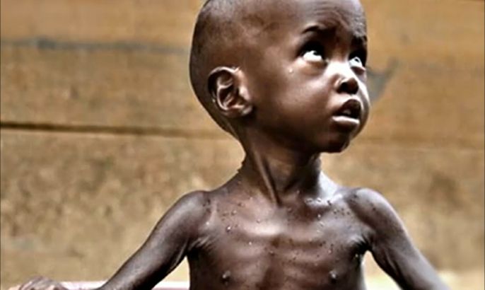840 مليون شخص يعانون من الجوع المزمن بالعالم