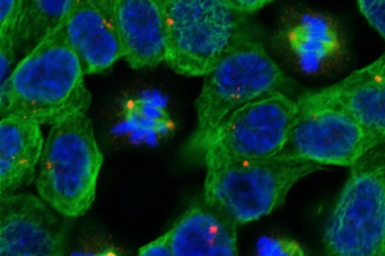 An image taken with a confocal microscope of a field of non-dividing and dividing human cancer cells is seen at The Institute of Cancer Research in London, in this handout photograph taken January 10, 2013. To match Insight CANCER-DRUGS/ REUTERS/The Institute of Cancer Research, London/Handout via Reuters (BRITAIN - Tags: HEALTH SCIENCE TECHNOLOGY) ATTENTION EDITORS � THIS IMAGE WAS PROVIDED BY A THIRD PARTY. NO SALES. NO ARCHIVES. FOR EDITORIAL USE ONLY. NOT FOR SALE FOR MARKETING OR ADVERTISING CAMPAIGNS. THIS PICTURE IS DISTRIBUTED EXACTLY AS RECEIVED BY REUTERS, AS A SERVICE TO CLIENTS