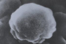 FILE - This December 1985 image provided by Tottori University, Tokyo shows a magnified view of the AIDS virus taken by researchers of the university's medical department. The photo, magnified 350,000 times, was taken with a scanning electron microscope and researchers said the virus of the deadly disease has a rugged surface. Sunday, June 5, 2011 marks 30 years since the first AIDS cases were reported in the United States. Nearly 30 million people have died of AIDS since the first five cases were recognized in Los Angeles in 1981. About 34 million people have HIV now, including more than 1 million in the United States.