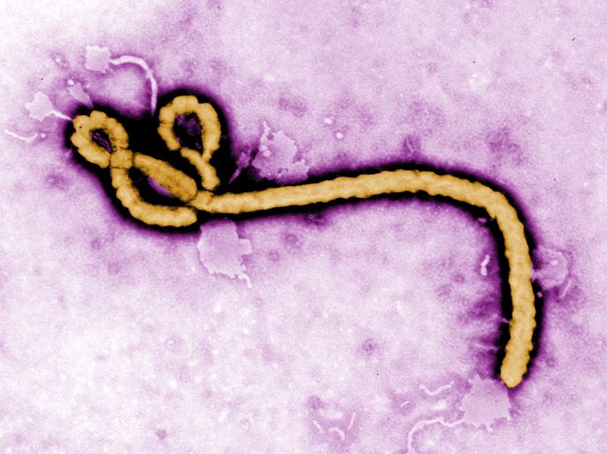 An undated handout image provided by the United States Centers for Disease Control and Prevention (CDC) on 05 August 2014 shows a colorized transmission electron micrograph (TEM) of an Ebola virus virion. An American doctor suffering from Ebola was improving at an Atlanta hospital, officials said, as reports emerged 04 August that he had received an experimental serum while still in Africa and near death. The Centers for Disease Control and Prevention (CDC) along with the US State Department, the US National Institute of Health and the World Health Organization (WHO) coordinated the delivery of the serum that Brantly and Writebol received, Samaritan's Purse said. EPA/Frederick A. Murphy / HANDOUT HANDOUT EDITORIAL USE ONLY