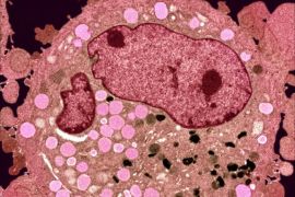 أمل لمرضى السرطان: بكتيريا قادرة على تدمير الأورام