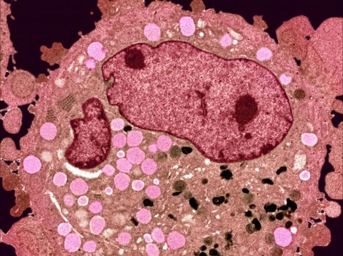 أمل لمرضى السرطان: بكتيريا قادرة على تدمير الأورام