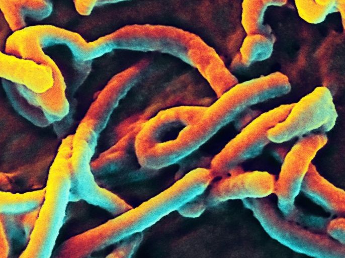 An image provided on 28 August 2014 by the National Institute of Allergy and Infectious Diseases shows a scanning electron micrograph of Ebola virus budding from the surface of a Vero cell of an African green monkey kidney epithelial cell line. EPA/NIAID / HANDOUT EDITORIAL USE ONLY / NO SALES