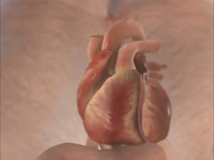تقنية إسعـاف جديدة تنقذ حياة مرضى النوبات القلبية