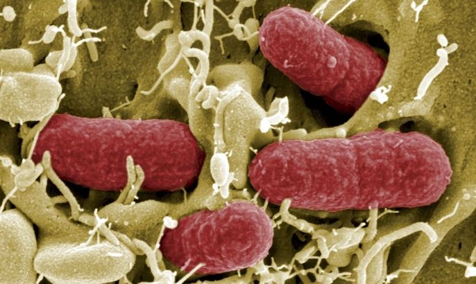An undated file picture taken with electronic microscope shows EHEC bacteria (enterohaemorrhagic Escherichia coli) in Helmholtz Centre for Infection Research in Brunswick. The deadliest outbreak of its type on record has so far killed 23 people -- 22 in Germany and one in Sweden. Striking suddenly in the middle of a hot and sunny May, the crisis has doctors struggling to explain the outbreak and public health authorities in one of Europe's most famously organised countries stumped as to how to manage it and how to stop it happening again. To match Special Report HEALTH/ECOLI-HUNT.