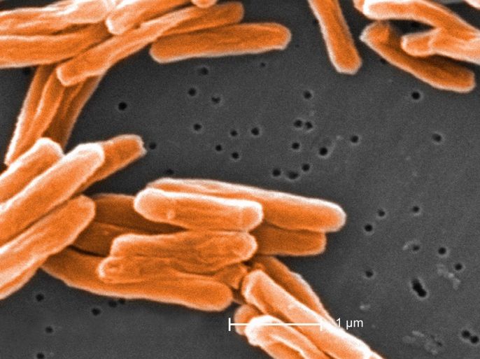 Electron micrograph of Mycobacterium tuberculosis