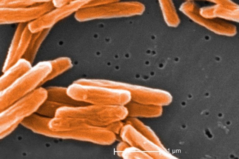 Electron micrograph of Mycobacterium tuberculosis