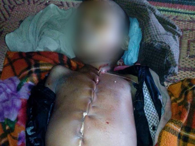 مستشفى بميانمار تنتزع أحشاء طفل روهنجي مريض وترده لذويه مقتولا