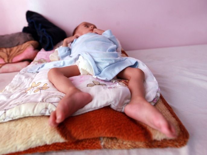 A Yemeni malnourished infant lies on a bed at a therapeutic feeding centre in the capital Sanaa on December 9, 2014. Over one million Yemeni girls and boys under 5 suffer from acute malnutrition, including 279,000 who suffer from severe acute malnutrition (SAM), in a situation exacerbated by political instability, multiple localized conflicts and chronic underdevelopment, according to UNICEF. AFP PHOTO/ MOHAMMED HUWAIS