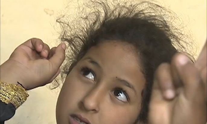دعوة للكشـف المبكر عن تأخر النطق لأطفال موريتانيا