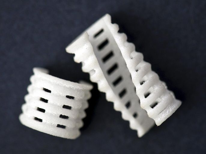 University of Michigan Health System photo shows trachea splints made with a "bioabsorbable" material using 3D printing in this handout image released to Reuters on April 29, 2015. U.S. doctors treated three infants with an often-fatal airway disease by implanting a 3-D printed medical device that improves breathing and changes shape as the children grow, the researchers reported on Wednesday. REUTERS/Leisa Thompson/UMHS/Handout via ReutersATTENTION EDITORS - THIS PICTURE WAS PROVIDED BY A THIRD PARTY. REUTERS IS UNABLE TO INDEPENDENTLY VERIFY THE AUTHENTICITY, CONTENT, LOCATION OR DATE OF THIS IMAGE. THIS PICTURE IS DISTRIBUTED EXACTLY AS RECEIVED BY REUTERS, AS A SERVICE TO CLIENTS. FOR EDITORIAL USE ONLY. NOT FOR SALE FOR MARKETING OR ADVERTISING CAMPAIGNS. NO ARCHIVES. NO SALES.