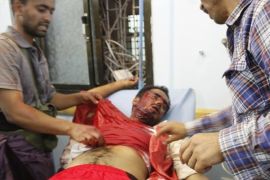 أحد الجرحى المدنيين جراء القصف الحوثي على تعز