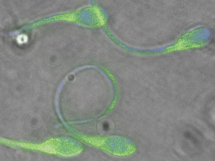 An undated electron microscope image shows sperm from human donors that posses only the mutated DEFB126 gene have a significantly reduced quantity of negatively charged sugars (green fluorescence) on their surface. Sperm that lack DEFB126, or the negatively charges sugars associated with the DEFB126 protein, have difficulty swimming though mucosal fluids of the female reproductive system. A genetic mutation that removes a coating of carbohydrates around sperm reduces their mobility and may explain why some men are less fertile than others, researchers said on July 21, 2011. The study, published in the journal Science Translational Medicine, found that couples who had the most trouble conceiving were those where the men inherited both copies of this mutant gene, one from their father and one from their mother.