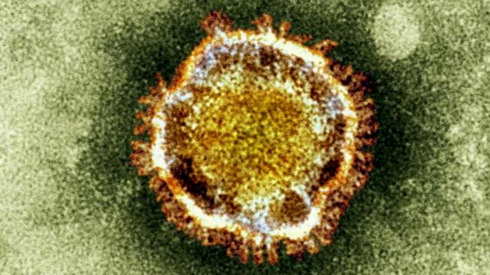 ‪فيروس كورونا ينتمي إلى عائلة الفيروسات التاجية‬  (أسوشيتد برس)