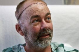 In this photo taken on Wednesday, June 3, 2015, transplant patient Jim Boysen sits in his hospital bed at Houston Methodist Hospital in Houston. Texas doctors say they have done the world's first partial skull and scalp transplant to help Boysen with a large head wound from cancer treatment. MD Anderson Cancer Center and Houston Methodist Hospital doctors announced Thursday, June 4 that they did the operation on May 22 at Houston Methodist. (Mayra Beltran/Houston Chronicle via AP)