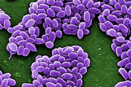 Spores from the Sterne strain of anthrax bacteria (Bacillus anthracis) are pictured in this handout scanning electron micrograph (SEM) obtained by Reuters May 28, 2015. A U.S. military base in Utah sent live anthrax samples to 51 labs in 17 states, Washington, D.C. and three foreign nations, more than previously disclosed, the Pentagon said on June 3, 2015 as officials worked to determine the scope of the problem. REUTERS/Center for Disease Control/Handout via Reuters THIS IMAGE HAS BEEN SUPPLIED BY A THIRD PARTY. IT IS DISTRIBUTED, EXACTLY AS RECEIVED BY REUTERS, AS A SERVICE TO CLIENTS. FOR EDITORIAL USE ONLY. NOT FOR SALE FOR MARKETING OR ADVERTISING CAMPAIGNS