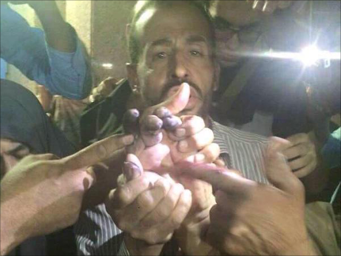 صورة نشرها ناشطون لأصابع أحد القتلى وواضح عليها علامات البصمة (الجزيرة)