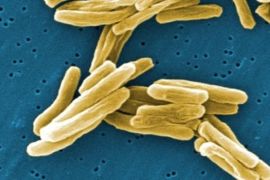 This 2006 image provided by the Janice Carr of the CDC shows the Mycobacterium tuberculosis (TB) bacteria in a high magnification scanning electron micrograph (SEM) image. SSanofi Pasteur is recalling all doses of its tuberculosis vaccine from the Canadian market because of concerns over the quality of the vaccine. Health Canada is announcing the recall, saying problems at Sanofi's manufacturing facility may have affected the quality of its vaccine.
