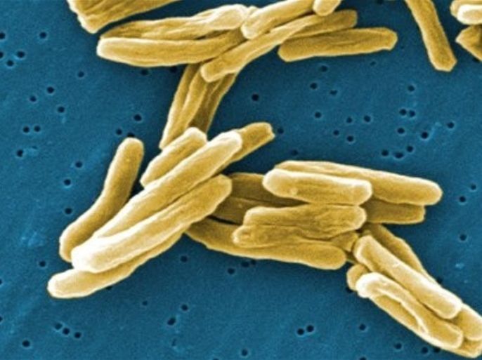 This 2006 image provided by the Janice Carr of the CDC shows the Mycobacterium tuberculosis (TB) bacteria in a high magnification scanning electron micrograph (SEM) image. SSanofi Pasteur is recalling all doses of its tuberculosis vaccine from the Canadian market because of concerns over the quality of the vaccine. Health Canada is announcing the recall, saying problems at Sanofi's manufacturing facility may have affected the quality of its vaccine.
