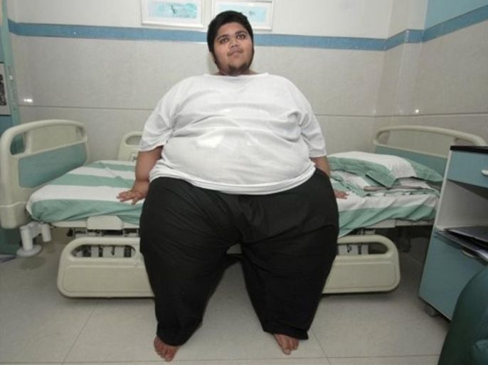 Dilkhush Patel, 17, a student of Indian origin who now lives in Kenya and weighs 248.3 kilograms (547.4 pounds) is seen after he underwent gastric bypass surgery at a hospital in Ahmadabad, India, Tuesday, July 28, 2009. Patel, a "super super obese" patient with a body mass index (BMI) of 97, about five times a normal person has undergone the surgery targeting to lose 150 kilograms ( 330.69 pounds) in the next one-and-a-half year. Dr. Mahendra Narwaria, who performed the surgery said, Patel was the first patient with such heavy weight to be operated for gastric bypass in the country.
