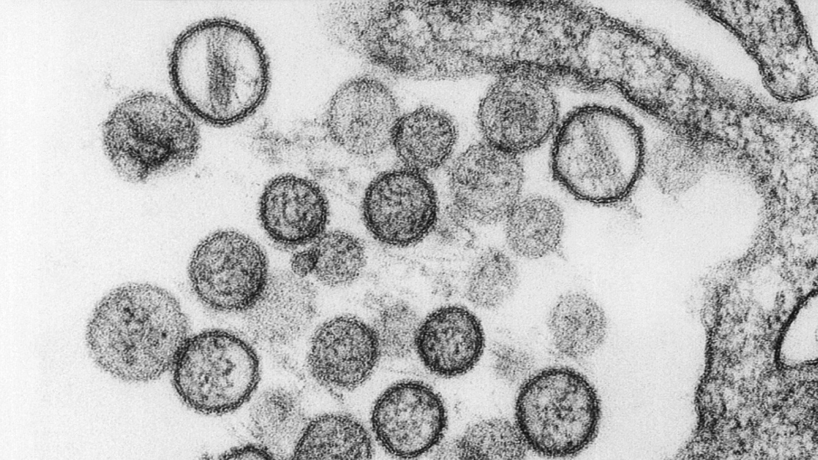 فيروسات هانتا تحت المجهر (رويترز)