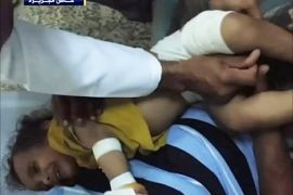 مستشفيات تعز تستقبل مزيدا من ضحايا قصف الحوثي