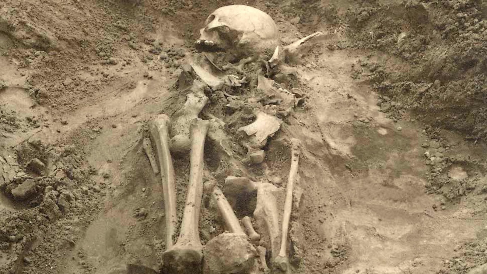 ‪عظام من قبر في أستونيا‬ (أسوشيتد برس)