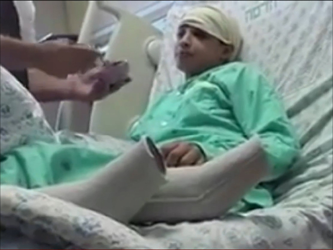 ‪صور مسربة سابقة للطفل مناصرة أثناء معالجته في المستشفى‬ صور مسربة سابقة للطفل مناصرة أثناء معالجته في المستشفى 