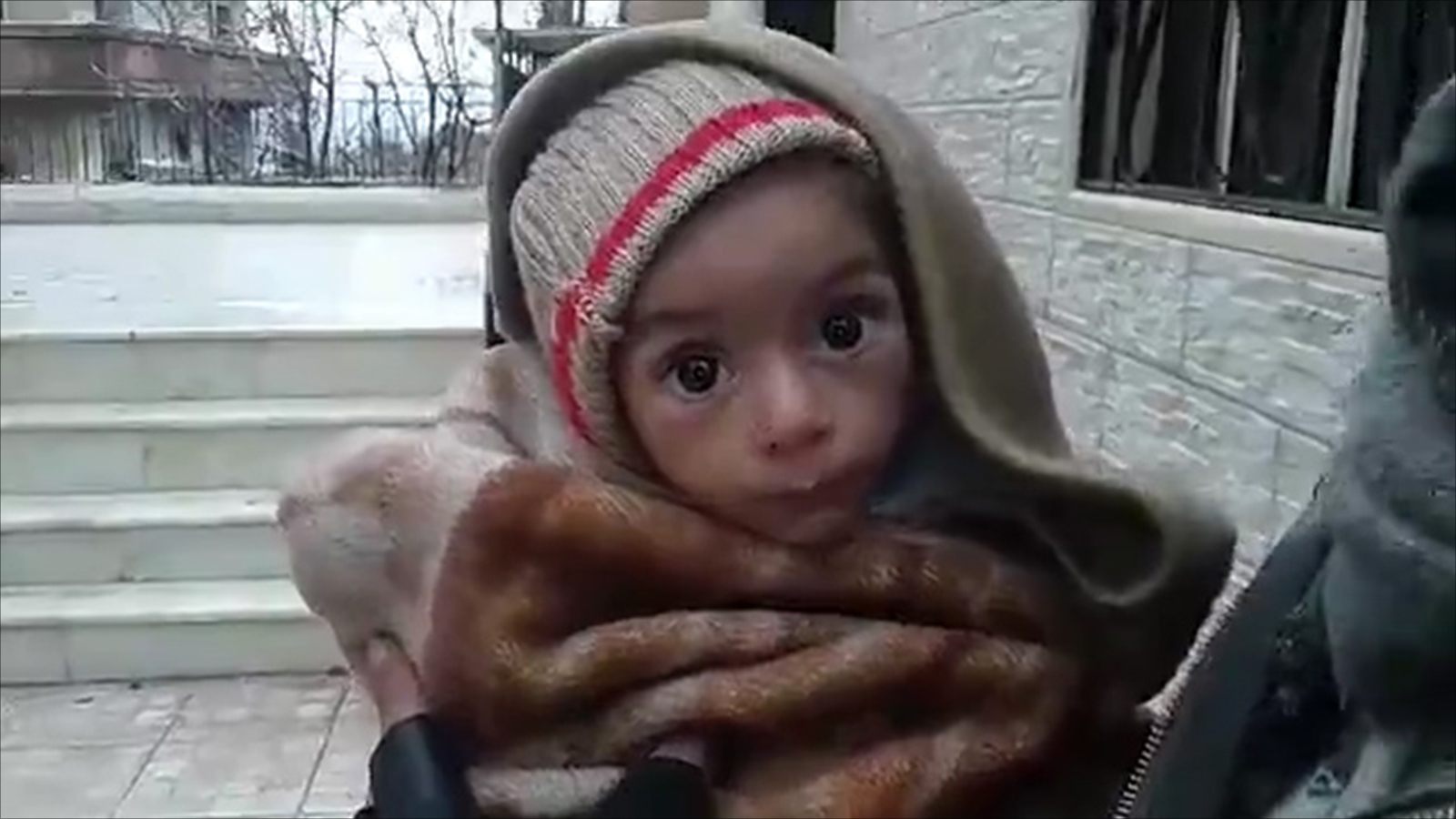 طفل يعاني نقص التغذية جراء حصار بلدة مضايا (ناشطون)