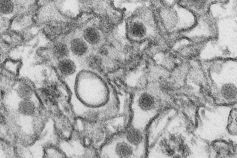 A transmission electron micrograph (TEM) shows the Zika virus, in an undated photo provided by the Centers For Disease Control in Atlanta, Georgia. The U.S. Centers for Disease Control and Prevention (CDC) extended its travel warning to another eight countries or territories that pose a risk of infection with Zika, a mosquito-borne virus spreading through the Caribbean and Latin America. REUTERS/CDC/Cynthia Goldsmith/Handout via Reuters FOR EDITORIAL USE ONLY. NOT FOR SALE FOR MARKETING OR ADVERTISING CAMPAIGNS. ATTENTION EDITORS - THIS PICTURE WAS PROVIDED BY A THIRD PARTY. REUTERS IS UNABLE TO INDEPENDENTLY VERIFY THE AUTHENTICITY, CONTENT, LOCATION OR DATE OF THIS IMAGE. EDITORIAL USE ONLY. NOT FOR SALE FOR MARKETING OR ADVERTISING CAMPAIGNS. NO RESALES. NO ARCHIVE. THIS PICTURE WAS PROCESSED BY REUTERS TO ENHANCE QUALITY. AN UNPROCESSED VERSION HAS BEEN PROVIDED SEPARATELY