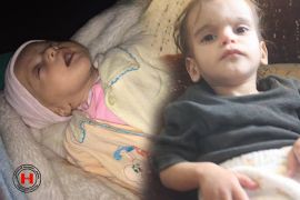 وفاة طفل يبلغ من العمر ثلاثة أشهر وطفلة أخرى بحالة خطرة جراء سوء التغذية وعدم توفر الأدوية بسبب الحصار المفروض على المدينة.