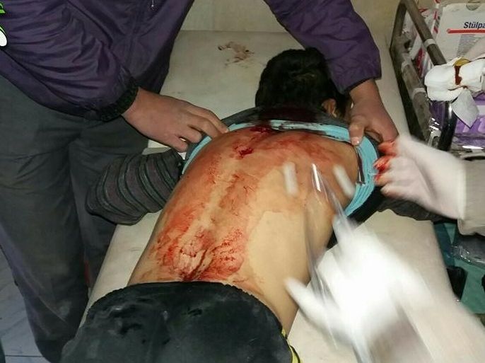 قتيلان وعدد من الجرحى جلهم أطفال جراء إلقاء طيران النظام براميل متفجرة على بلدات عندان وحيان بريف حلب الشمالي.1