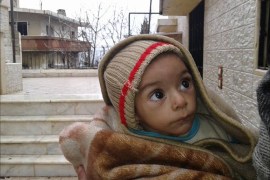 طفل يعاني سوء التغذية في بلدة مضايا بريف دمشق
