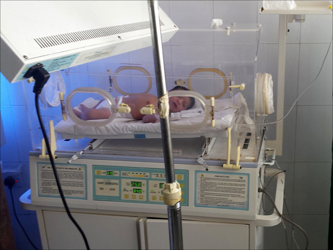 ‪انعدام الأكسجين في مستشفيات مدينة تعز يفاقم معاناة الأطفال الخدج (‬ الجزيرة نت)
