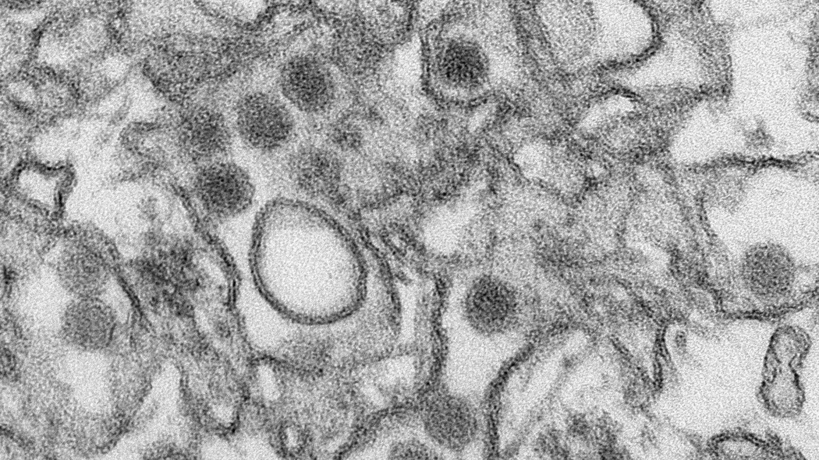 ‪فيروس زيكا تحت المجهر‬  (رويترز)