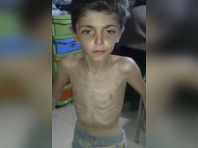 ارتفاع حالات الموت جوعا في مضايا بريف دمشق