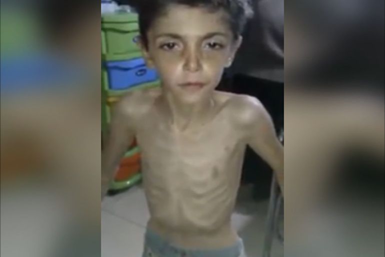 ارتفاع حالات الموت جوعا في مضايا بريف دمشق