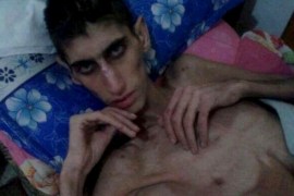 An emaciated man in Madaya is seen in this undated picture taken from social media. Warnings of widespread starvation are growing as pro-government forces besiege an opposition-held town in Syria and winter bites, darkening the already bleak outlook for peace talks the United Nations hopes to convene this month. To match MIDEAST-CRISIS/SYRIA-TOWN Handout via Social Media Websites/Syrian Observatory For Human Rights ATTENTION EDITORS - THIS PICTURE WAS PROVIDED BY A THIRD PARTY. REUTERS IS UNABLE TO INDEPENDENTLY VERIFY THE AUTHENTICITY, CONTENT, LOCATION OR DATE OF THIS IMAGE. FOR EDITORIAL USE ONLY. NOT FOR SALE FOR MARKETING OR ADVERTISING CAMPAIGNS. THIS PICTURE IS DISTRIBUTED EXACTLY AS RECEIVED BY REUTERS, AS A SERVICE TO CLIENTS. EDITORIAL USE ONLY. NO RESALES. NO ARCHIVE.