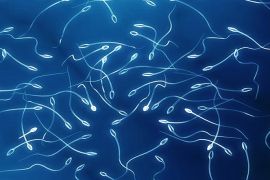 صورة لحيوانات منوية sperms