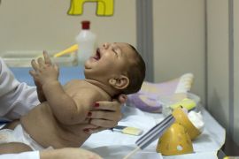 Maria Lys who was born with microcephaly undergoes physical therapy at a therapy treatment center in Joao Pessoa, Brazil, Thursday, Feb. 25, 2016. Researchers from the Centers of Disease Control and Prevention continue to fan out across one of Brazil's poorest states in search of mothers and infants for a study aimed at determining whether the Zika virus is causing babies to be born with unusually small heads. (AP Photo/Andre Penner)