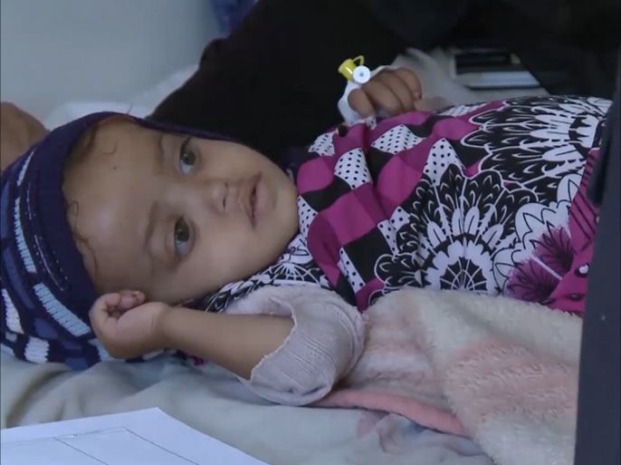 قال منسق الشؤون الإنسانية في الأمم المتحدة باليمن، جيمي ماك غولدريك، إن نحوَ مائة وثلاثة عشر يمنيا يموتون يوميا جراء نقص المواد الطبية والمساعدات الإنسانية