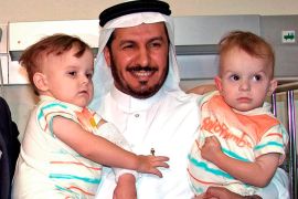 الموسوعة - epa000394903 Saudi Dr. Abdullah al Rabiah holds the separated Polish twins Daria and Olga Kolacz