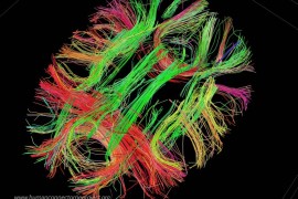 ADVANCE FOR USE MONDAY, JUNE 22, 2014 AND THEREAFTER - This image provided by the Laboratory of Neuro Imaging in June 2015 shows pathways of signals in the brain from the Connectome Scanner dataset. The fibers are color-coded by direction: red is left-right, green is front-back and blue is up-down. (Courtesy of the Laboratory of Neuro Imaging and Martinos Center for Biomedical Imaging, Consortium of the Human Connectome Project - www.humanconnectomeproject.org, www.loni.usc.edu via AP)