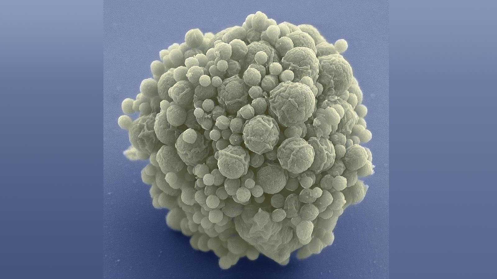 Искусственная клетка 3. Микоплазма гениталиум. Селекция микроорганизмов. Искусственные бактерии. Микроорганизмы селекциясы.
