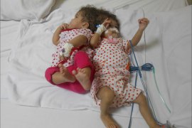 تعاني إحدى الطفلتين من عيوب خلقية والأخرى من مياه على قشرة المخ-تصوير المراسل-6مايو