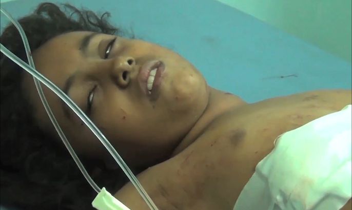 مقتل 17 مدنيا في قصف الحوثيين وسط تعز