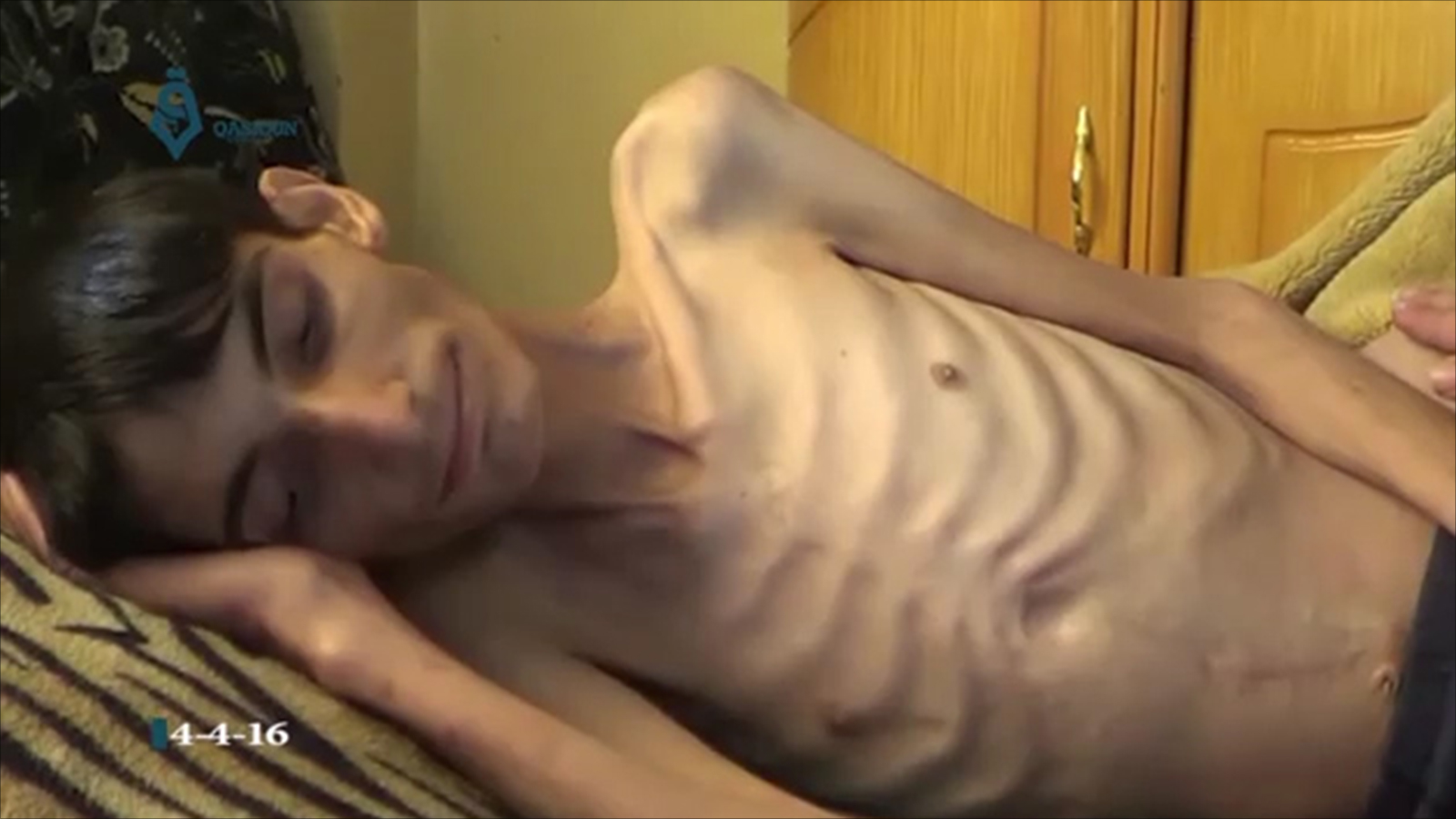 ‪محمد شعبان من مضايا تعرض لمعاناة قبل وفاته‬ (ناشطون-أرشيف)