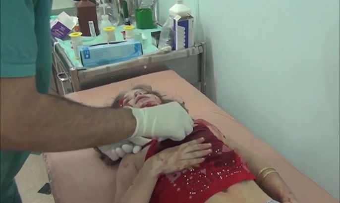 القصف الجوي يخرج مستشفيات حلب من الخدمة
