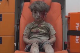 طفل حلب