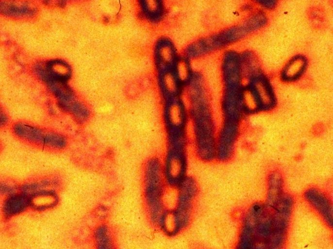 A microscopic picture of spores and vegetative cells of Bacillus anthracis which causes the disease anthrax is pictured in this undated file photograph. The first case in Britain of anthrax in livestock for nearly 10 years has been confirmed by health authorities in Wiltshire, southwest England, where a cow died of the disease last week. Anthrax is a naturally occurring bacterial disease which primarily affects herbivorous animals. The last livestock case in Britain was in 2006. REUTERS/STR